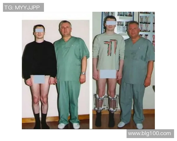 足球明星逆袭之路断骨增高手术背后的故事与启示